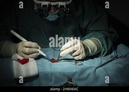 La chirurgo femminile esegue un intervento microchirurgico su un braccio. Foto Stock