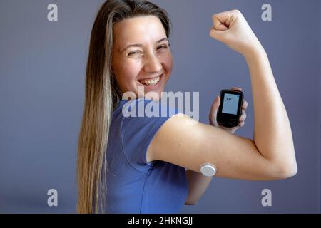 Ragazza con un flash glucosio monitor, patch sulla sua mano, facendo gesto di potenza Foto Stock