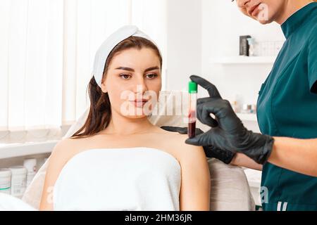 Plastificazione. Il cosmetologo mostra al cliente un tubo con sangue. Preparazione del sangue per le iniezioni di ringiovanimento. Il concetto di cosmo professionale Foto Stock