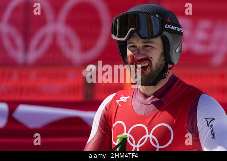 Pechino, Cina. 07th Feb 2022. Daniel Hemetsberger, in Austria, ha un volto sanguinoso al termine della gara di discesa degli Alpine Ski Men presso il centro nazionale di sci alpino Yanqing alle Olimpiadi invernali di Pechino 2022 lunedì 7 febbraio 2022. Mayer ha vinto la medaglia di bronzo. Foto di Paul Hanna/UPI Credit: UPI/Alamy Live News Foto Stock