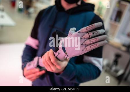 Uomo in possesso di una protesi del braccio in plastica stampata nel 3D a Zaragoza Makerspace Foto Stock