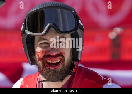 Pechino, Cina. 07th Feb 2022. Daniel Hemetsberger, in Austria, ha un volto sanguinoso al termine della gara di discesa degli Alpine Ski Men presso il centro nazionale di sci alpino Yanqing alle Olimpiadi invernali di Pechino 2022 lunedì 7 febbraio 2022. Mayer ha vinto la medaglia di bronzo. Foto di Paul Hanna/UPI Credit: UPI/Alamy Live News Foto Stock