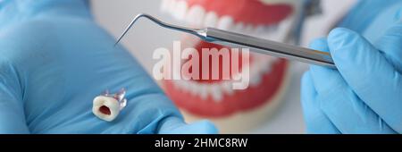 Medico dentista che tiene il dente artificiale di plastica nelle sue mani sullo sfondo della mascella closeup Foto Stock