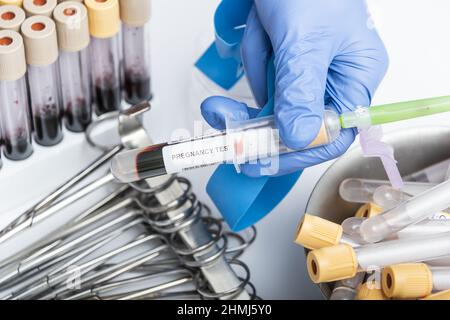 Gli scienziati tengono in mano una provetta con campione di sangue per il test DI GRAVIDANZA. Foto Stock