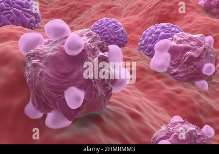 Cellule tumorali ovariche - primo piano vista 3D illustrazione Foto Stock