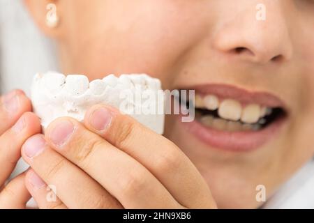 L'adolescente sta tenendo un modello del getto dentale all'inizio del trattamento ortodontico accanto ai suoi denti dopo che il trattamento è stato completato. Foto Stock