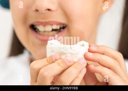 L'adolescente sta tenendo un modello del getto dentale all'inizio del trattamento ortodontico accanto ai suoi denti dopo che il trattamento è stato completato. Foto Stock