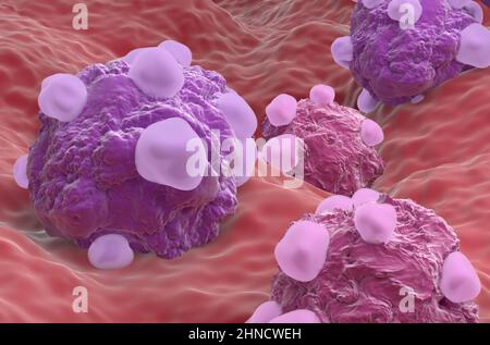 Variazioni delle cellule tumorali ovariche - primo piano vista 3D illustrazione Foto Stock
