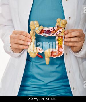 Trattamento della colite, flatulenza, indigestione in assistenza sanitaria. Modello anatomico dell'intestino con patologia nelle mani del medico, primo piano Foto Stock