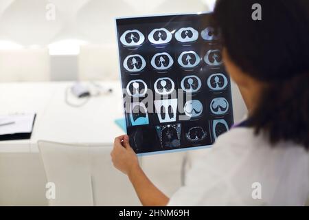 Vista posteriore del medico di etnia femminile che analizza la scansione a raggi X o MRI mentre lavora in ospedale, fuoco selettivo. Medico che guarda lo screening TC, utilizzando la diag Foto Stock