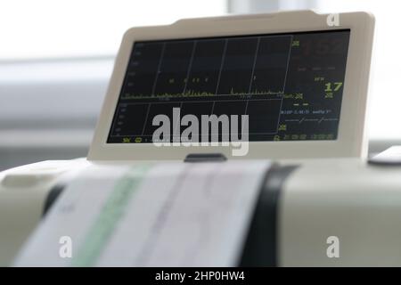 Monitoraggio elettronico della macchina per cardiotocografia contrazioni cardiache fetali dell'utero. Stampa del referto del cardiogramma in uscita elettrocardiogramma in manodopera Foto Stock