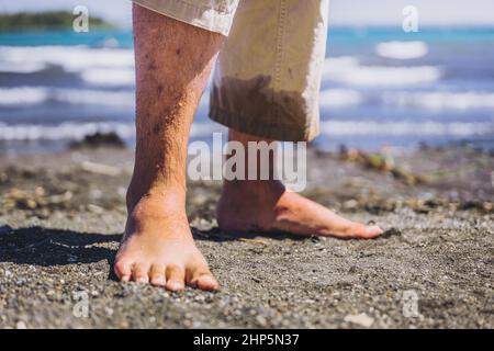 Gambe inferiori dell'uomo con urti e macchie sulla pelle. Cheratosi pilaris. Concetto di cura della pelle Foto Stock