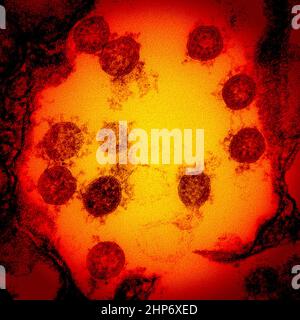 Micrografia elettronica a trasmissione di particelle di virus SARS-COV-2, isolate da un paziente ca. 2020 Foto Stock