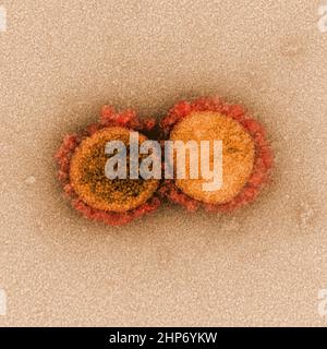 Micrografia elettronica a trasmissione di particelle di virus SARS-COV-2, isolate da un paziente ca. 2020 Foto Stock