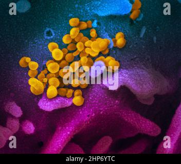 Novel Coronavirus SARS-COV-2: Questa immagine al microscopio elettronico a scansione mostra SARS-COV-2 (giallo), noto anche come 2019-nCoV, il virus che causa COVID-19-isolato da un paziente negli Stati Uniti, emergente dalla superficie delle cellule (blu/rosa) coltivate nel laboratorio ca. 13 febbraio 2020 Foto Stock