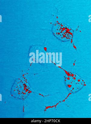 La proteina prionica, mostrata in rosso, può diventare infettiva e causare malattie neurodegenerative. Qui quattro cellule nervose in un topo illustrano come la proteina prionica infettiva si muove all'interno delle cellule lungo le connessioni filari dei neuriti che le cellule nervose usano per comunicare con le cellule adiacenti ca. 2019 Foto Stock