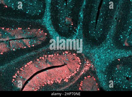 Il cervelletto di un cervello di topo affetto da Niemann-Pick di tipo C (NPC), un raro disturbo neurologico. I ricercatori NIH stanno conducendo gli studi per avanzare i trattamenti per NPC e malattie rare simili ca. 2016 Foto Stock