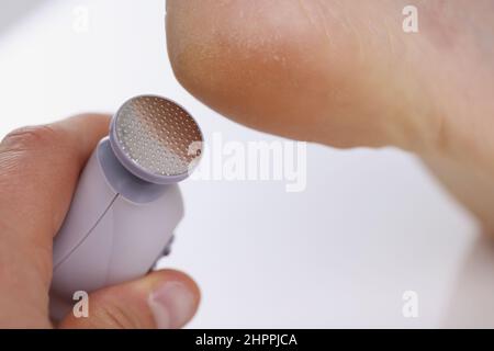 Peeling al callo con una perforatrice professionale per pedicure. Trattamento del piede termale Foto Stock
