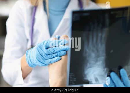 La dottoressa esamina la radiografia delle gambe del paziente. Foto Stock