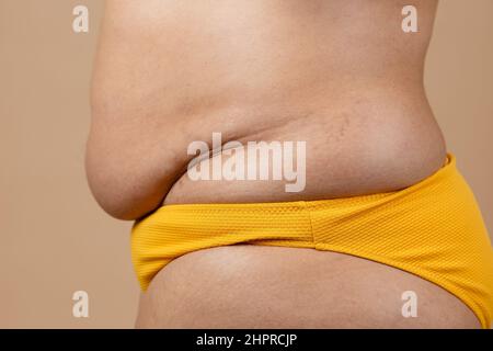 Immagine ritagliata di grasso sovrappeso donna incinta sag stomaco con obesità, grasso in eccesso in pantaloni gialli. Perdita di peso rapida. Foto Stock