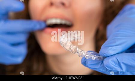 Medico ortodontista in guanti che mette in silicone invisibile trasparente bretelle sui denti della donna in clinica dentista, bocca closeup vista. Denti di correzione t Foto Stock