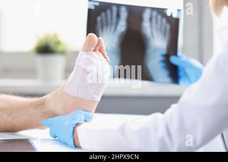 Un medico guarda una radiografia della gamba ferita di un uomo, sfocata Foto Stock