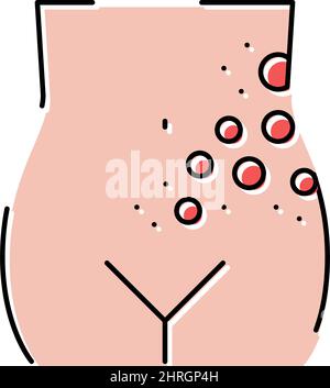 lichen herpes zoster malattia colore icona vettore illustrazione Illustrazione Vettoriale