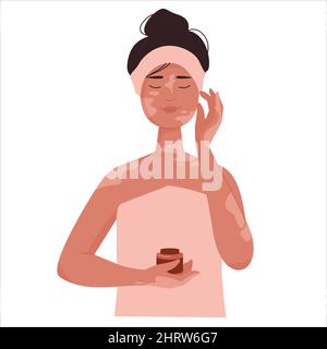 Cute Girl con Vitiligo prendere cura del peccato Illustrazione Vettoriale