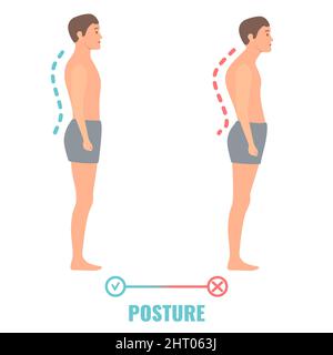 Buona e cattiva postura, illustrazione concettuale Foto Stock