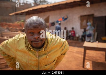 Ritratto di un uomo africano con sindrome di Down è in un villaggio africano. Foto Stock