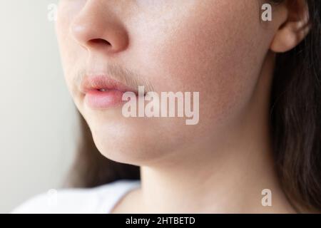 Un primo piano del volto di una donna con un baffo sul labbro superiore. Il concetto di epilazione e rimozione dei peli. Foto Stock