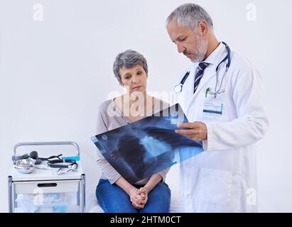 Semplificare i raggi X in modo che possa capire. Shot di un medico che spiega una radiografia a un paziente. Foto Stock