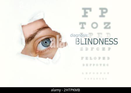 Poster della malattia della cecità con la tabella dei test oculari e l'occhio blu a sinistra. Isolato su bianco Foto Stock