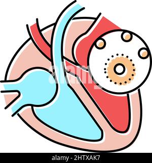 immagine vettoriale dell'icona colorata della malattia da miocardite Illustrazione Vettoriale