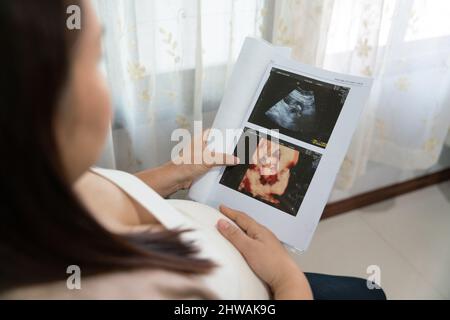 Giovane donna incinta asiatica che guarda l'immagine ecografica, gravidanza con raggi X. Foto Stock