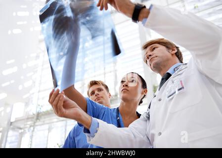 Esame dei raggi x. Un team medico che guarda la radiografia del CAN. Foto Stock