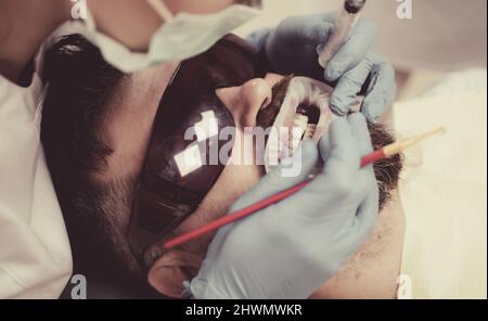 Denti sbiancanti con luce ultravioletta - lampada UV. Uomo presso l'ufficio del dentista che ha un trattamento dentale. Uomo che sceglie il colore dei denti al dentista. Foto Stock