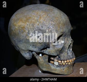 La deformazione intenzionale del cranio è stata eseguita in culture antiche di tutto il mondo. E 'stato fatto sui bambini per motivi sociali dalle culture antiche. Foto Stock