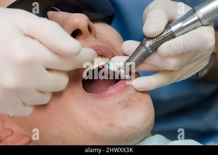 Dentista che indossa occhiali di sicurezza e maschera per bocca utilizzando un trapano per rimuovere la placca dai denti di un giovane paziente maschio, indossando anche una speciale protezione gl Foto Stock