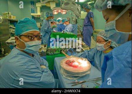 Chirurghi che perfezionano un trapianto di fegato al Samsung Medical Center, Seoul, Corea del Sud Foto Stock