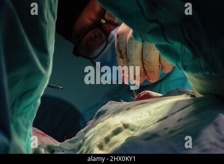 (Nota dei redattori l'immagine contiene contenuti grafici) i medici palestinesi nella striscia di Gaza eseguono un intervento chirurgico di plastica sul naso di patientís. Le cliniche di chirurgia cosmetica sono diventate popolari dappertutto la striscia. Foto Stock