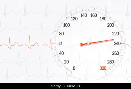 Alta frequenza della pressione sanguigna sullo sfondo delle righe di cardiogramma Illustrazione Foto Stock