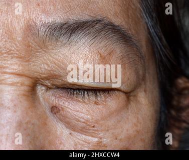 Rughe intorno ad occhio chiuso della donna anziana asiatica. Primo piano. Foto Stock