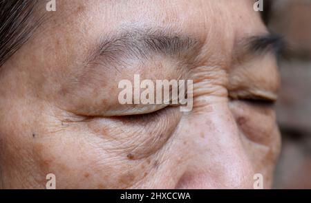 Rughe intorno ad occhio chiuso della donna anziana asiatica. Primo piano. Foto Stock