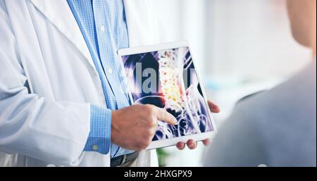 Questa è l'area che ha subito lesioni. Shot di un medico irriconoscibile che mostra una scansione radiologica a un paziente anziano. Foto Stock