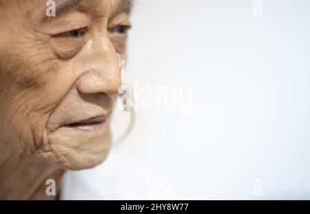 Il vecchio paziente affetto da cancro ha ricevuto nutrizione per intubazione nasogastrica. Foto Stock