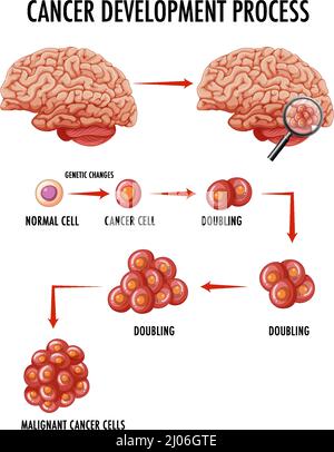 Diagramma che mostra l'illustrazione del processo di sviluppo del cancro Illustrazione Vettoriale