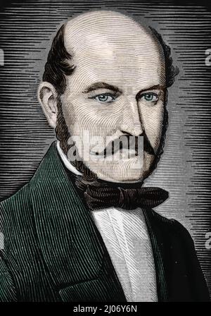 Portrait d'Ignace Philippe Semmelweis (1818-1865) medecin obostetricien hongrois qui oeuvra pour l'hygiene des Mains (Ignaz Semmelweis medico e scienziato tedesco-ungherese nato nel Regno d'Ungheria, Impero austriaco, ora noto come pioniere delle procedure antisettiche) Gravure fin 19eme siecle Collection privee Foto Stock