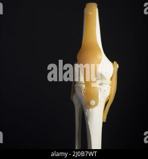 Modello didattico dimostrativo in plastica meniscus articolare medico del ginocchio Foto Stock