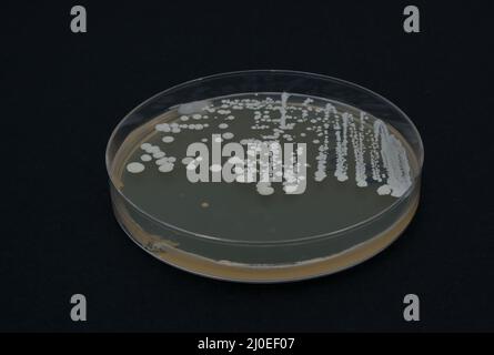 foto della crescita di colonie batteriche su agar nutriente Foto Stock